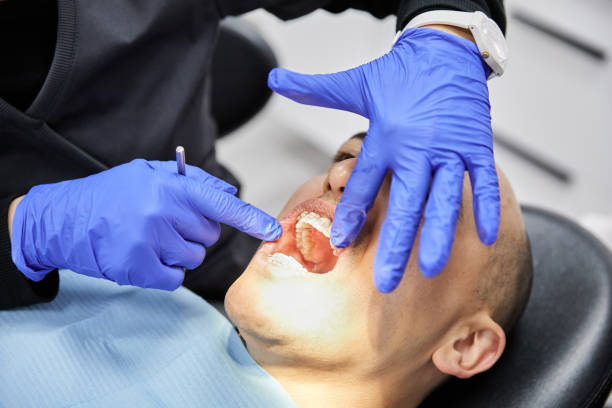 Best Emergency Dentist for Knocked-Out Tooth in Leesport, PA